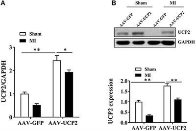 Downregulation of Uncoupling Protein 2(UCP2) Mediated by MicroRNA-762 Confers Cardioprotection and Participates in the Regulation of Dynamic Mitochondrial Homeostasis of Dynamin Related Protein1 (DRP1) After Myocardial Infarction in Mice